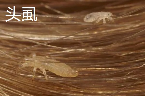哪些害虫很常见,包括苍蝇、蟑螂、蚊子等种类