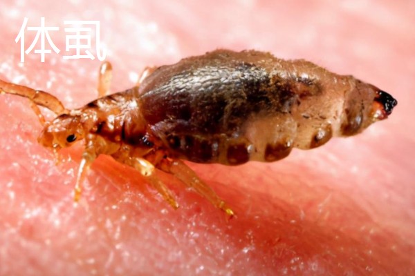 哪些害虫很常见,包括苍蝇、蟑螂、蚊子等种类