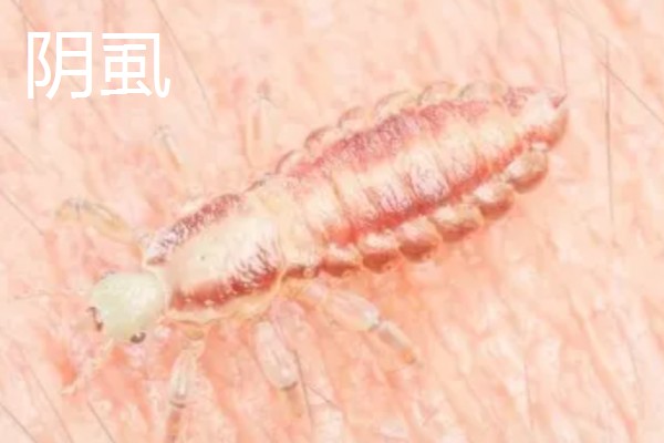 哪些害虫很常见,包括苍蝇、蟑螂、蚊子等种类