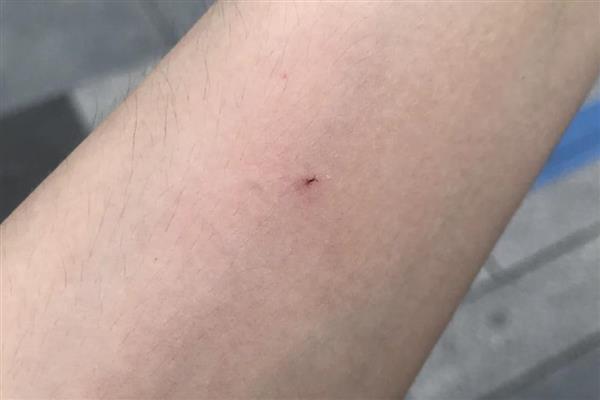 腰特别细的蜂有没有毒，细腰蜂和马蜂都有毒性